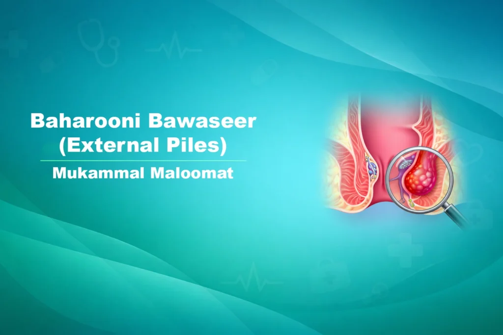 Bahar wali bawaseer — bawaseer ki doosri qisam